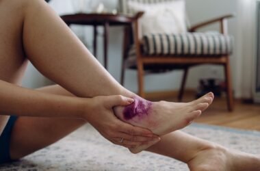 How To Heal A Sprained Ankle Overnight